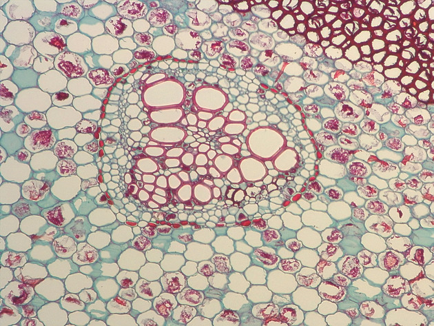 Fern Stem Slides - Fernstem 03 200X